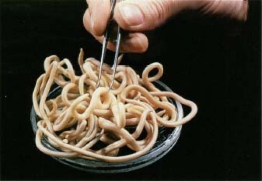 File:Tapeworms.jpg