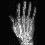 XrayRhand.gif