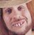 HillbillyTeeth.jpg