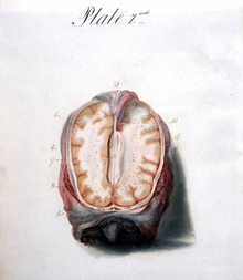 Illustration of Brain.png
