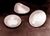 Breastimplants.jpeg