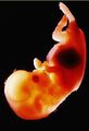 Fetus.jpg